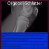 Osgood Schlatter Hastalığı